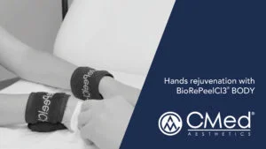 Hands rejuvenation with BioRePeelCI3® BODY