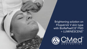 Brightening solution on Fitzpatrick V skin type with BioRePeelCI3® FND + LUMINESCENS®